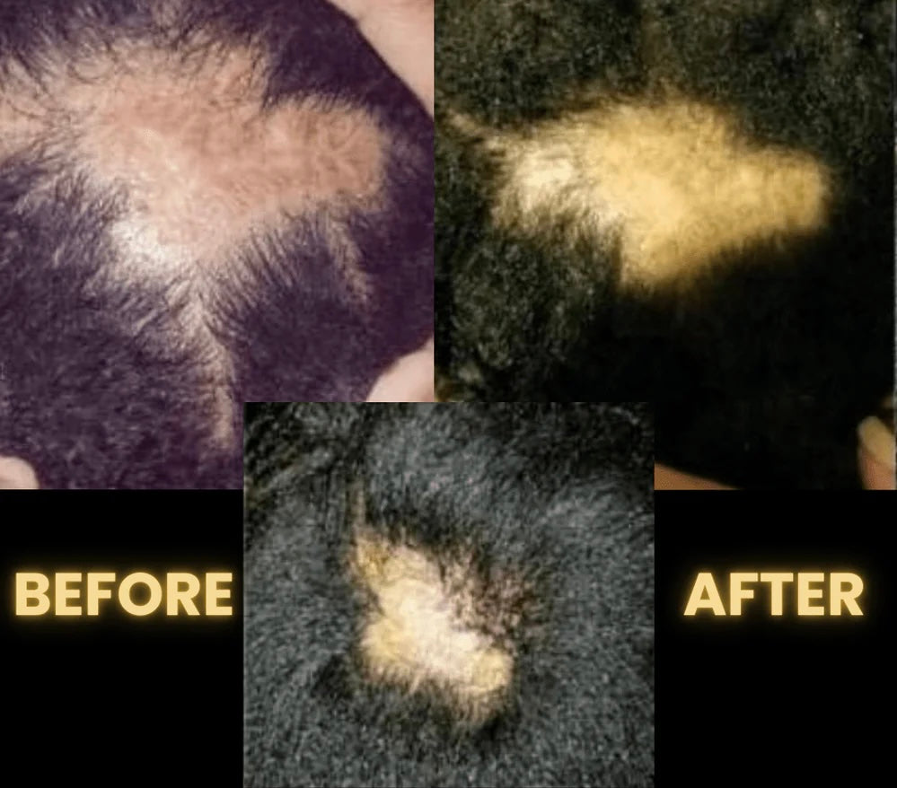Botanical Hair Growth Oil