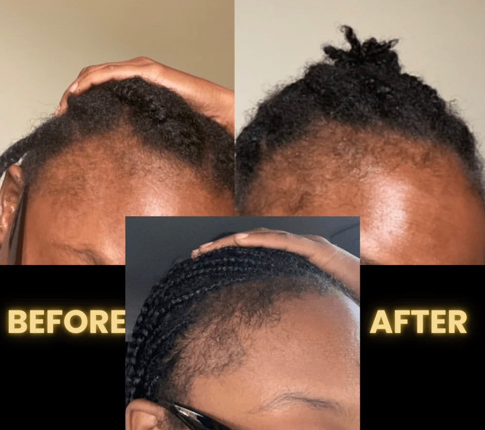 Botanical Hair Growth Oil