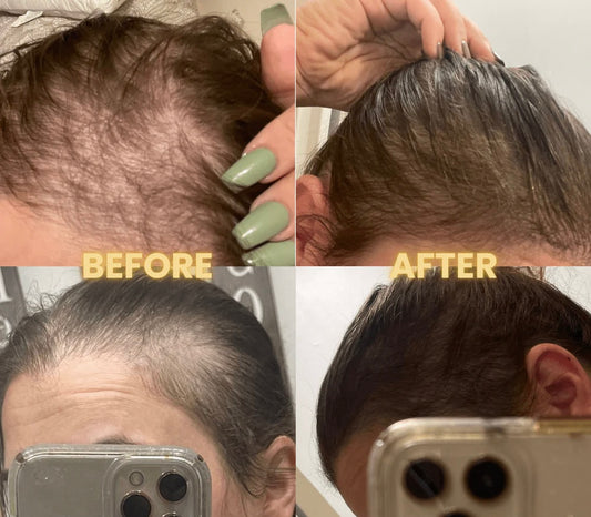 Botanical Hair Growth Oil